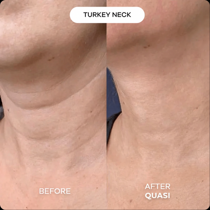 Collagen Neck Mask (free gift)
