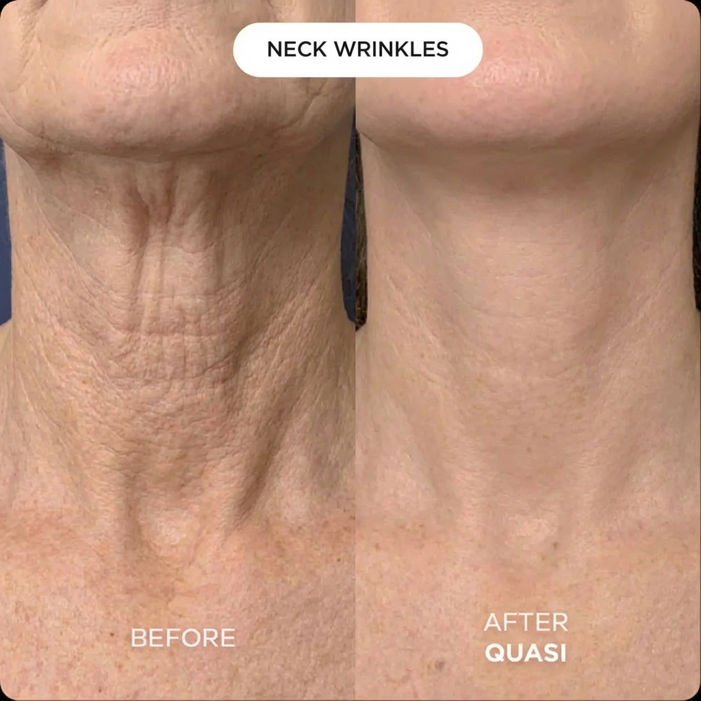 Collagen Neck Mask
