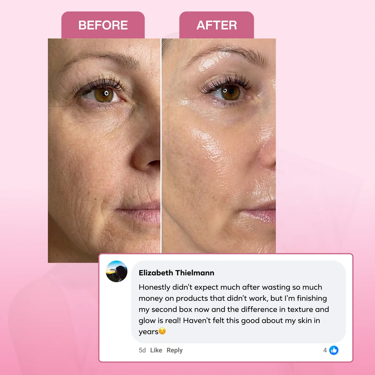 Collagen Mask Bundle